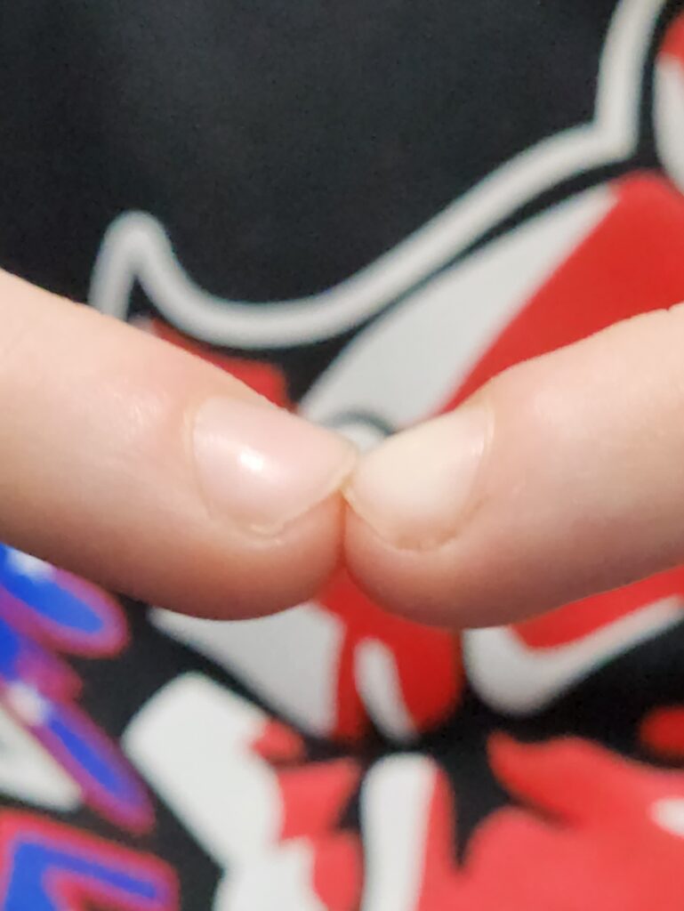 Two fingers pressed together where one fingernail appear a bit higher than the other